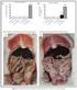 Comparison of Two Fetal Lung Maturity Tests Analytical Validation and Preliminary Clinical Assessment of the LBC Test and the TDx FLM II Assay