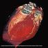Double diagnosis of coronary artery disease and left ventricular non-compaction case study