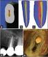 Shaping ability of RaCe rotary instruments laboratory study