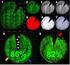 Problems of Corneal Endothelial Image Binarization