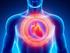 Kardiomiopatia, bezobjawowa dysfunkcja, ostra i przewlekła niewydolność serca co to oznacza w świetle współczesnych wytycznych?