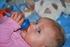 Żywienie wcześniaków i noworodków z małą urodzeniową masą ciała