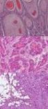 Charakterystyka epidemiologiczno-kliniczna 705 nowotworów gruczołów ślinowych