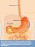 Analysis of results endoscopic examination of upper part of digestive tract in children and youth with gastroesophageal reflux disease