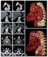 Asymptomatic thoracic stentgraft collapse treated conservatively