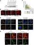 Expression of caveolin-1 in peritumoral stroma is associated with histological grade in ovarian serous tumors