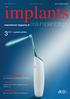 implants oral implantology wydanie polskie Opis przypadku Komplikacje w implantoprotetyce Wywiad Jason Kennedy o wytycznych DIEM 2