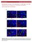 Pro-tumoral immune cell alterations in wild type and Shbdeficient mice in response to 4T1 breast carcinomas