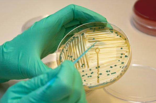 Badania obciążeniowe Celem badań obciążeniowych jest ocena stabilności mikrobiologicznej produktu lub tempa wzrostu wybranych grup drobnoustrojów podczas przechowywania w zalecanych warunkach