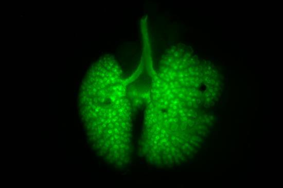 Lungs from a 14.5-day-old mouse embryo.