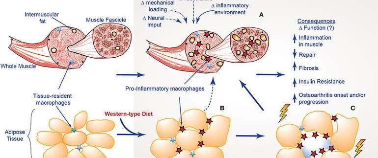 O T Y Ł O Ś Ć Nutrients. 2018 Mar 30;10(4). Obesity, Inflammation, Toll-Like Receptor 4 and Fatty Acids. Rogero MM i wsp.