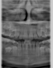 kwadranty Xios XG Supreme 3D Endo