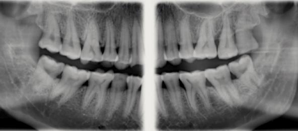 Sidexis 4 Galileos Implant CEREC Guide 2