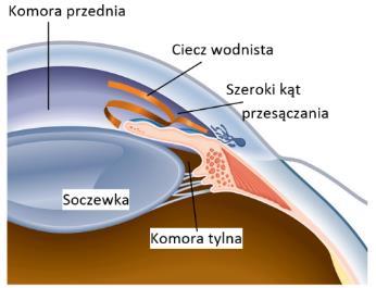 Okresowo mogą wystąpić bóle gałek ocznych, bóle głowy, zamazanie widzenia określane jako obraz tęczowych kół wokół źródeł światła. Objawy te często nie są kojarzone ze schorzeniem oczu.