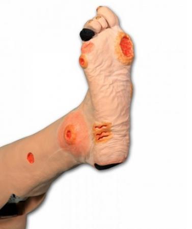 Model pozwala na zaobserwowanie następujących zmian: Wrzody tętnicze, Nekrotyczne palce, piętę Eschara, stopę Charcota, owrzodzenia palców zapalenie tkanki łącznej paznokieć dystroficzny, cętki na