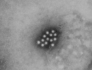 7 Wirusy przenoszone drogą pokarmową Neurotropowe Enterowirusy Poliowirus Parechowirus Wirus Nipah TBE Enterotropowe