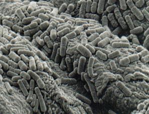 Adhezja Lactobacillus do nabłonka