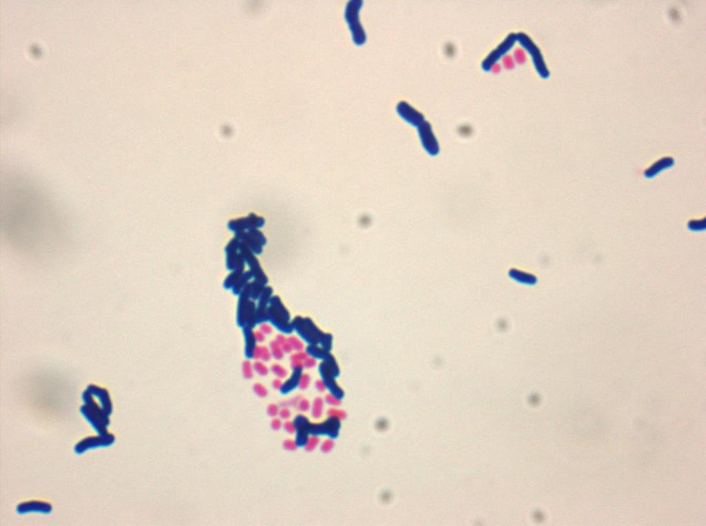 Koagregacja Bifidobacterium longum KN4 i