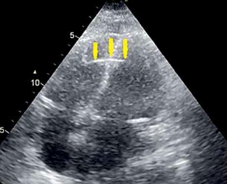 Szymon Domagała et al. Complications of electrotherapy Table I.