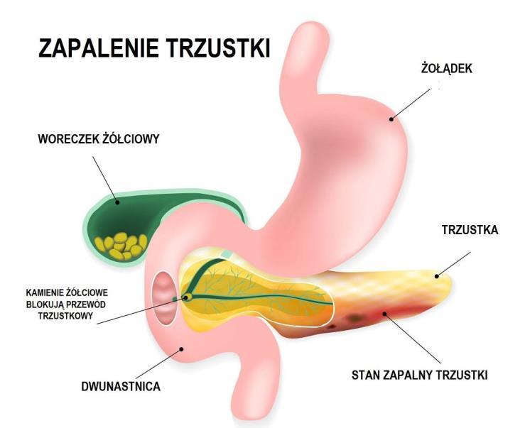 Choroby trzustki