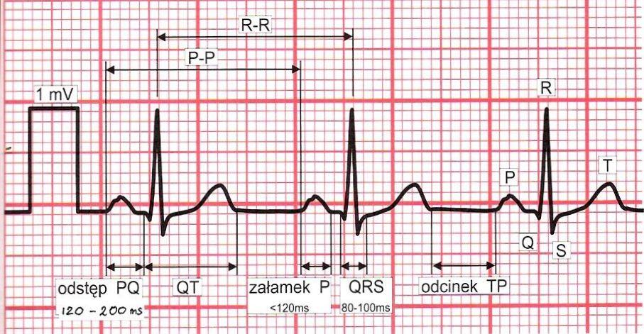 EKG Najważniejsze narzędzie w diagnostyce kanałopatii Szukając kanałopatii w EKG zwracamy uwagę na: - ocenę zaburzeń rytmu -