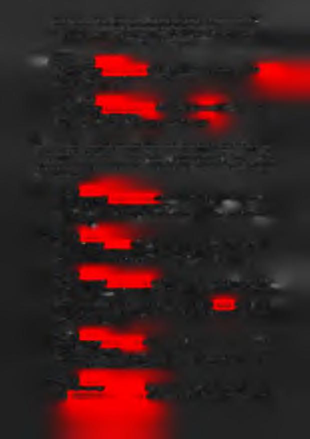 11. Sprawa w PZON (do 16 r. ż ) upośledzenie umysłowe le Wnioski: długi okres orzeczenia zaliczony do osób niepełnosprawnych bez 7 na dde, niedowidzenie 12.