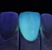 Naturalna fluorescencja VITA VMK Master potrafi sprostać wszystkim wymogom, które stawiamy przed nowoczesną ceramiką - czyli indywidualność, wysoki stopień jaskrawości kolorów oraz wyjątkowa