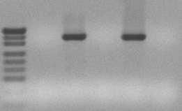M. ZAWADA i wsp. 28 1. Dawca 2. Biorca przed allonmsct 3. Biorca +30 doba po allonmsct CC 4. Biorca +138 doba po allonmsct MC 5. Biorca +150 po allonmsct R.
