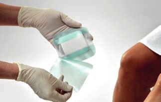 Biatain Silicone Aplikacja i usuwanie opatrunku Użyć folii