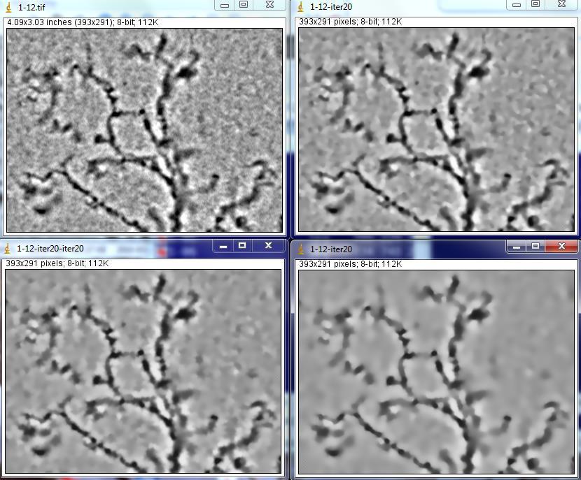 Rys. 5.12 Oryginalne zdjęcie (na górze po prawej) i trzy przykłady stosowania dyfuzji anizotropowej przy różnych ustawieniach parametrów. 5.7 SUBTRACT BACKGROUND Jednym z poważniejszych problemów w przypadku obrazów uzyskanych w świetle przechodzącym jest nierównomierne oświetlenie tła.