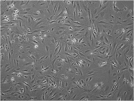 G766R/wt mice are smaller than their wild-type littermates Dis3 W e i g h t [g] http://www.