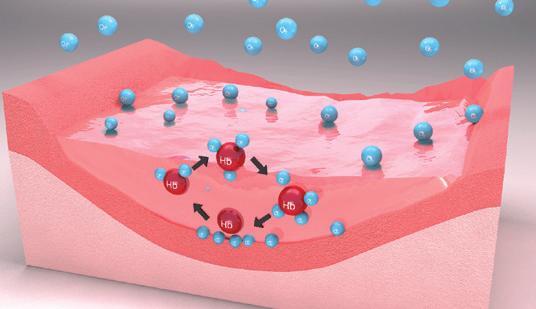 Granulox to wyrób medyczny klasy III zawierający hemoglobinę w zaawansowanym technologicznie systemie dostarczania. 1 2 1.