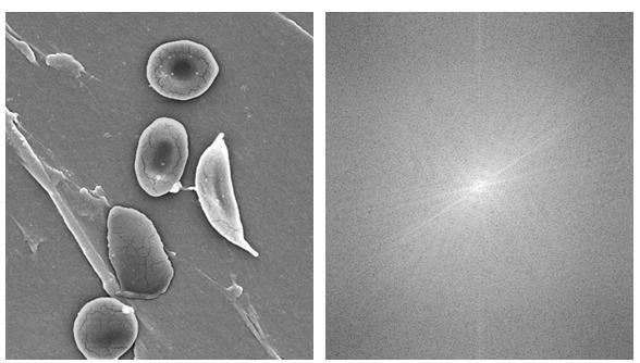 Dyskretna Transformata Fouriera (DFT) img = cv2.imread('cell.jpg',0) f = np.fft.