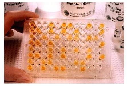 Test ELISA w kierunku anty-hiv Micro plate ELISA