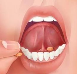 Tabletki podjezykowe Zawierają głównie substancje o działaniu ogólnym Charakteryzują się