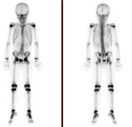 spis treści / table of contents W numerze 2/2019... 75 Konferencje naukowo-szkoleniowe studentów kierunku lekarskiego i elektroradiologii 79 Zastosowanie PET/CT w neurologii 89 Compressed SENSE.
