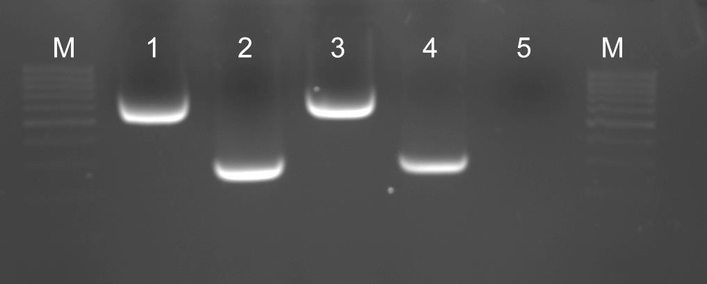 W przypadku każdego zastosowanego zestawu do izolacji DNA, otrzymywano produkty reakcji PCR (Rys. 5)