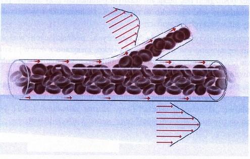 Hemoreologia Lepkość efektywna krwi Zjawisko zbierania osocza (sieciowy efekt