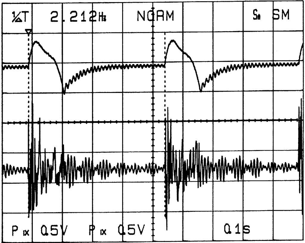 Voltage outputs from sensors measured for deflection patterns applied by cams I, III, IV metryczny drgań ADXL200 o czułości 300 mv/g oraz tensometry foliowe o rezystancji 123 Ω i stałej K = 2,21.