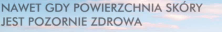 lub są łagodne). DAWKOWANIE: Leczenie maścią Protopic powinno być zapoczątkowane przez lekarzy z doświadczeniem w rozpoznawaniu i leczeniu atopowego zapalenia skóry.