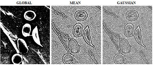 Progowanie adaptacyjne th2 = cv2.adaptivethreshold(img_gray,255,cv2.adaptive_thresh_mean_c,\ cv2.