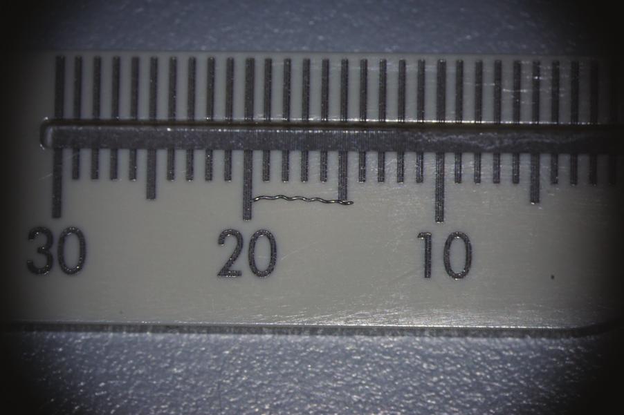 The length of the tool was 5.5 mm (Fig. 11). The canals were prepared using the chemo-mechanical method with rotary ProTaper Next (Dentsply Maillefer ).