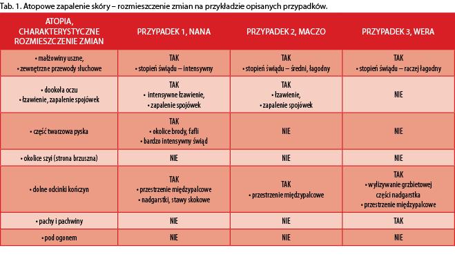 klinicznych 6 Kolejne nasilenie objawów miało miejsce pod koniec marca 2015 roku.