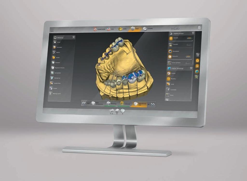 08 / 09 inlab CAD SW 16.0 technik dentystyczny zasługuje na dobre oprogramowanie Nowe oprogramowanie inlab CAD SW 16.0 spełnia jeszcze więcej potrzeb techników.