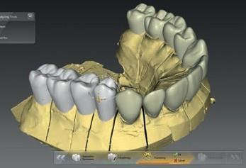 10 / 11 Moduł podstawowy inlab CAD SW Narzędzia do profesjonalnego projektowania Moduł podstawowy inlab CAD SW 16.