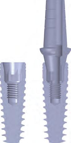 implanty Implanty Dentystyczne Premium Bio3 IMPLANTS Połączenie stożkowe Bio3 System implantów stożkowych Bio3 zapewnia