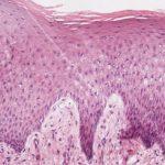 Torbiel śluzowa pęcherzyka żółciowego u psa opis przypadku 9 2. Tsukagoshi T. i wsp.: Decreased gallbladder emptying in dogs with biliary sludge or gallbladder muc ocele. Vet Radiol Ultrasound.