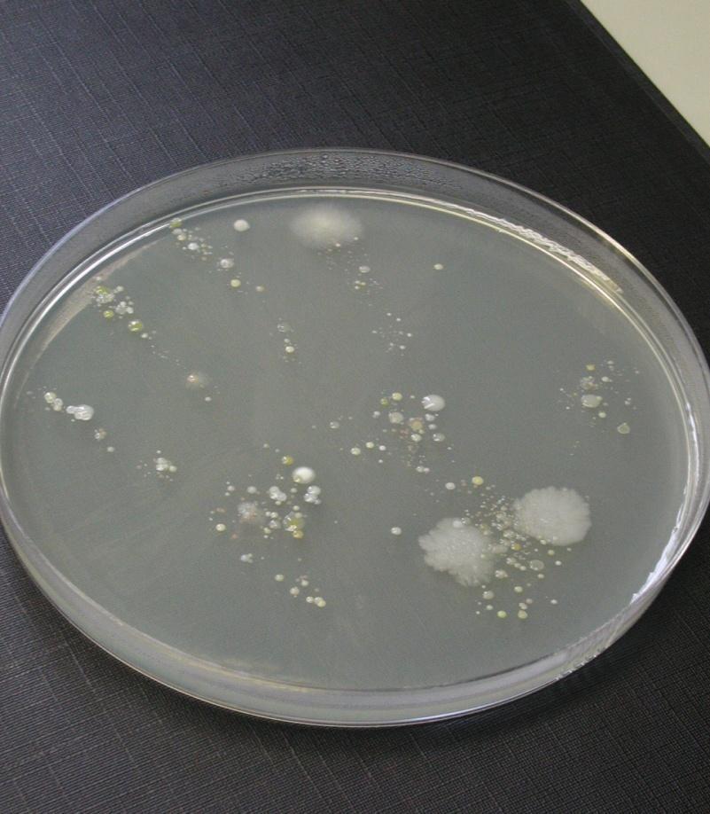 11 Higiena Osobista jest Istotna! Zdjęcie: Kolonie bakteryjne na stałym podłożu.