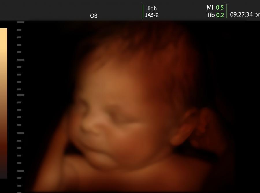 Film o rozwoju dziecka W drugiej sytuacji edukacyjnej 26 osobom 14 K i 12 M wyświetlono film Claud a Edelmann a The first days of life (Pierwsze dni życia), przedstawiający rozwój dziecka w łonie