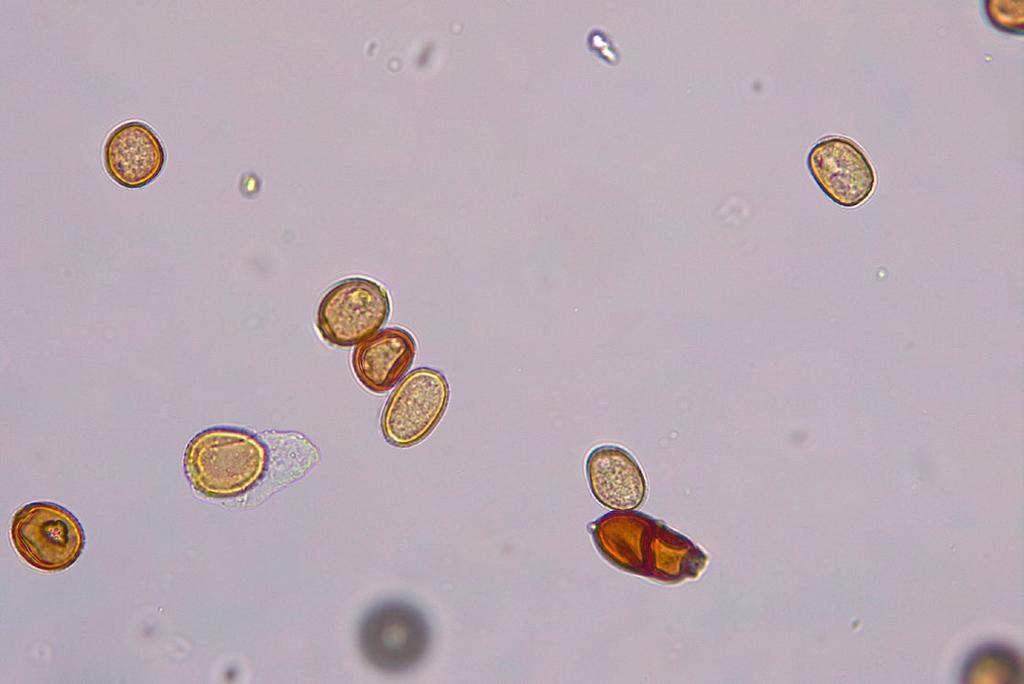 Przegląd Przyrodniczy XXIX, 1 (2018) Fot. 3. Zarodniki P. komarovii (40x): a i b urediniospory, c skupienia urediniospor i teliospor, d teliospora (fot. A. Kaczmarek). Photo 3. P. komarovii spores (40x): a and b urediniospores, c clusters of urediniospores and teliospores, d teliospores (photo by A.